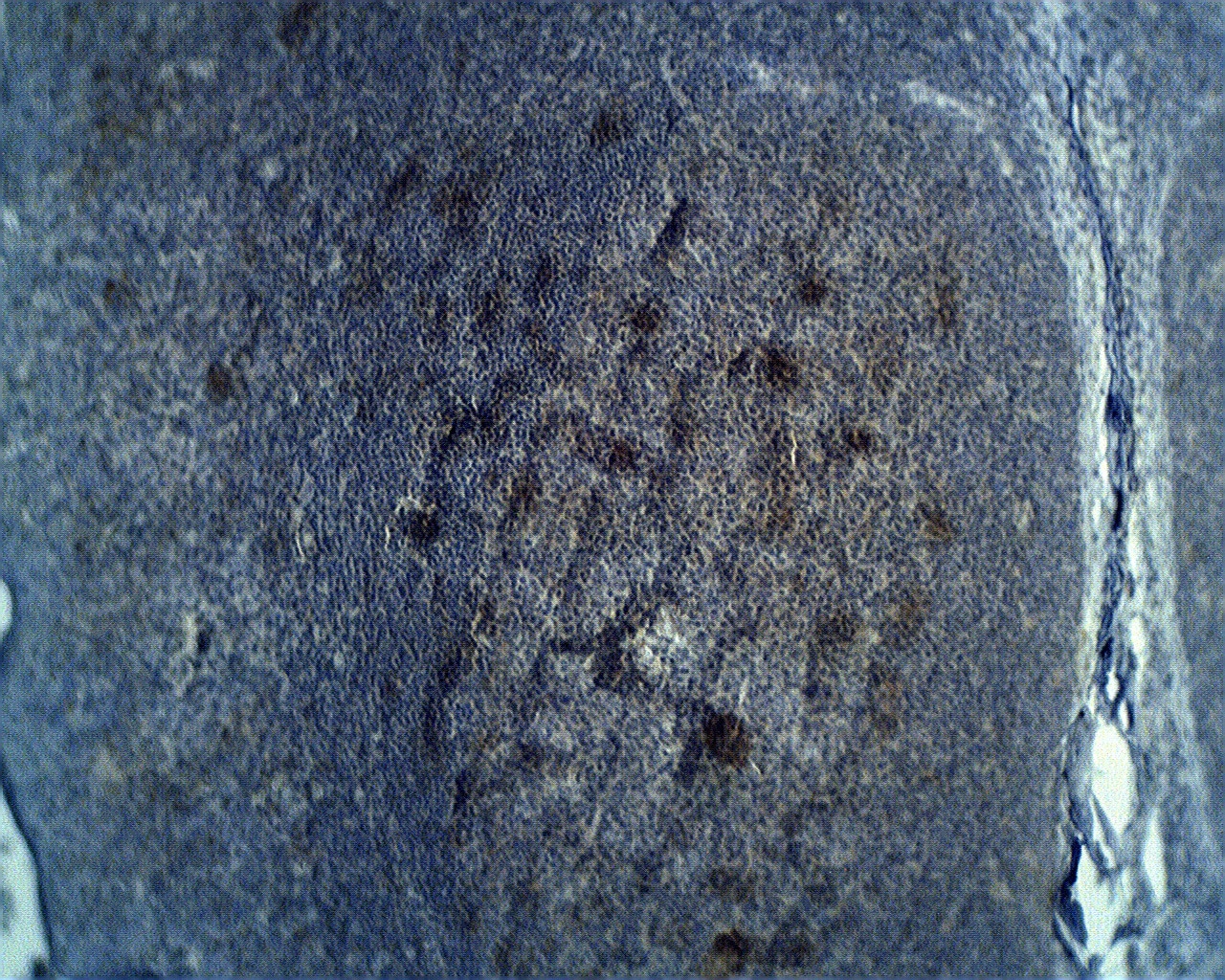ADAMDEC1 Antibody