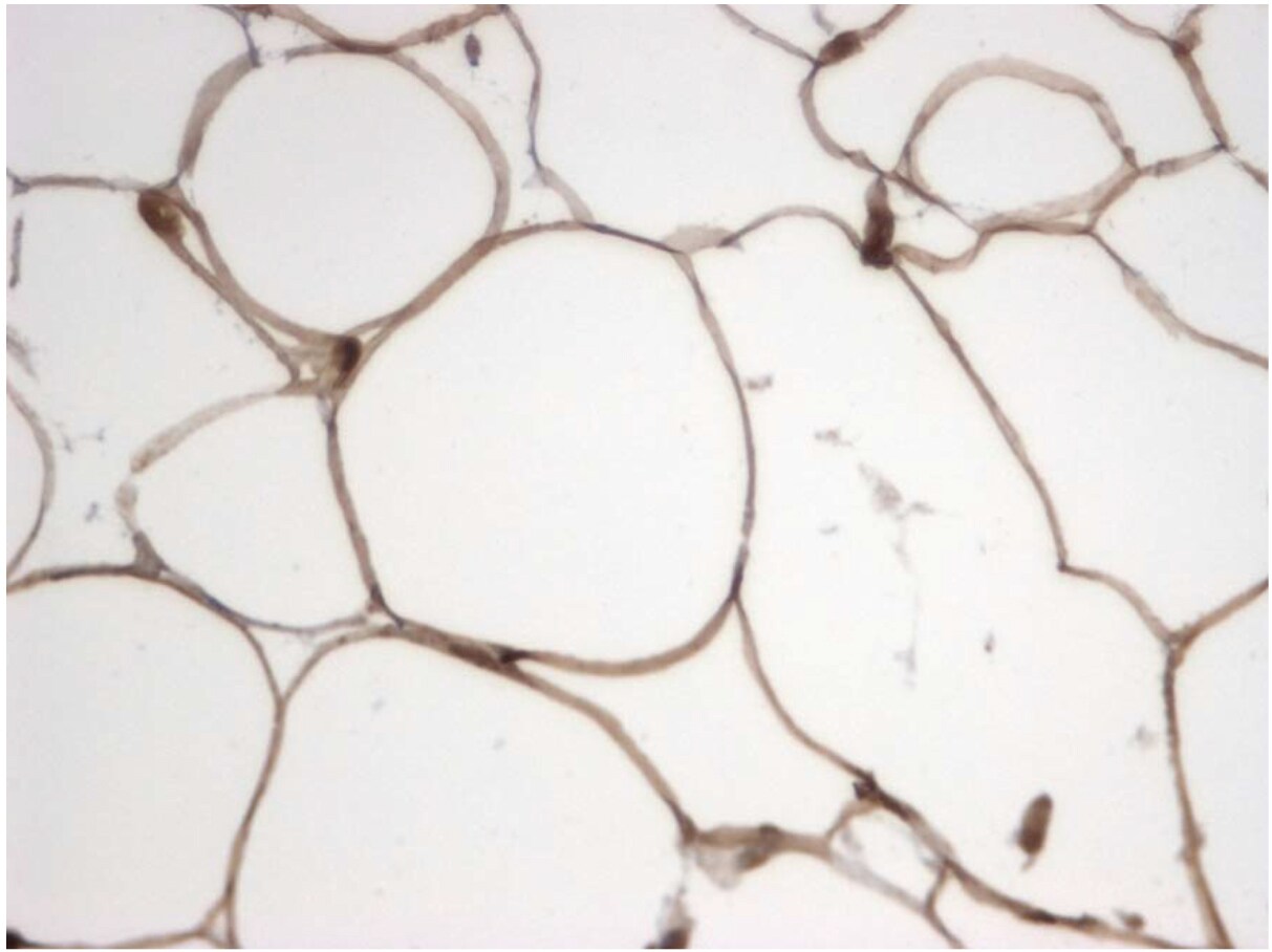 Monoglyceride Lipase Antibody