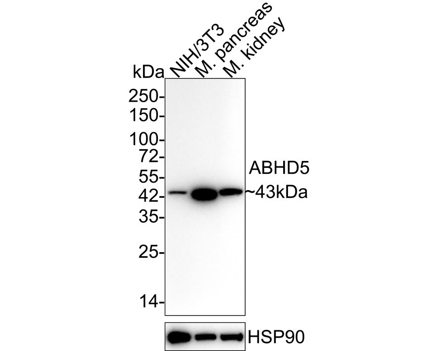 Abhd5 Antibody (JE60-62) Western Blot: Abhd5 Antibody (JE60-62) [NBP3-31989]