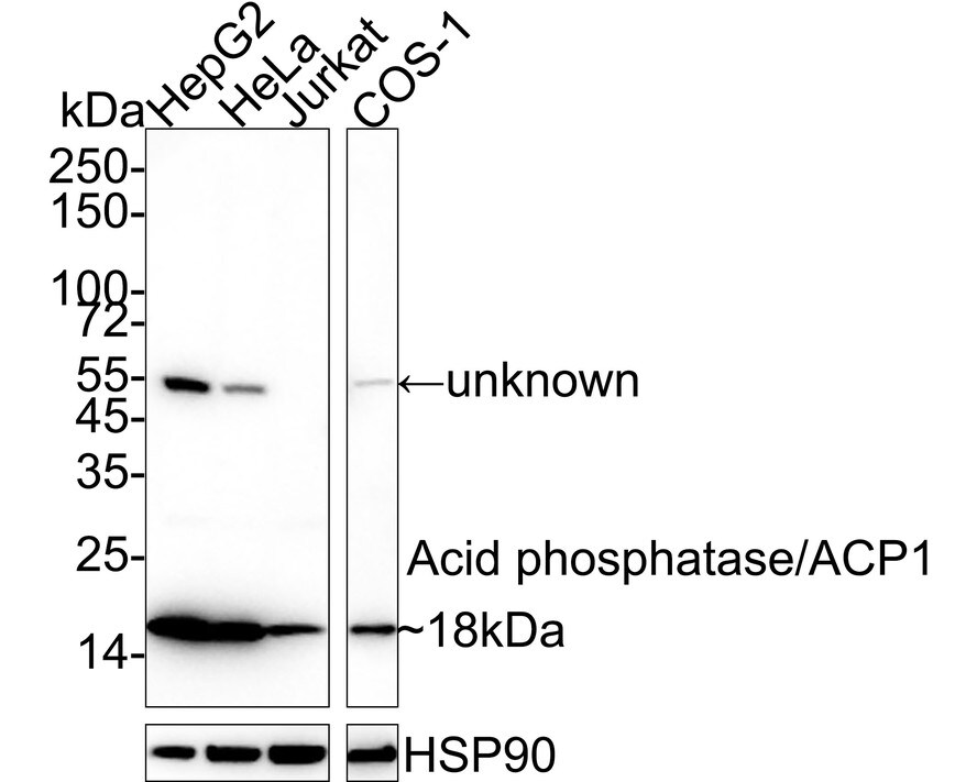 LMW-PTP/ACP1 Antibody (PSH04-57) Western Blot: LMW-PTP/ACP1 Antibody (PSH04-57) [NBP3-31992]