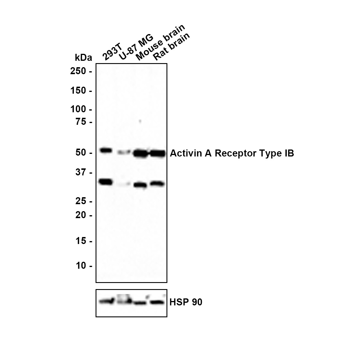 Activin RIB/ALK-4 Antibody (JE38-48) Western Blot: Activin RIB/ALK-4 Antibody (JE38-48) [NBP3-31998]