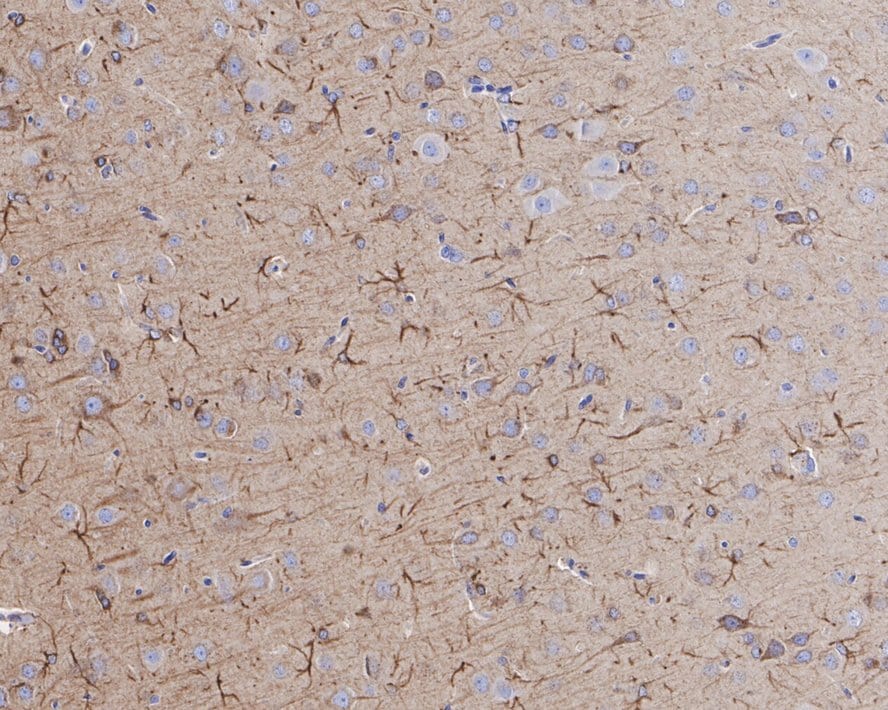 Activin RIB/ALK-4 Antibody (JE38-48)