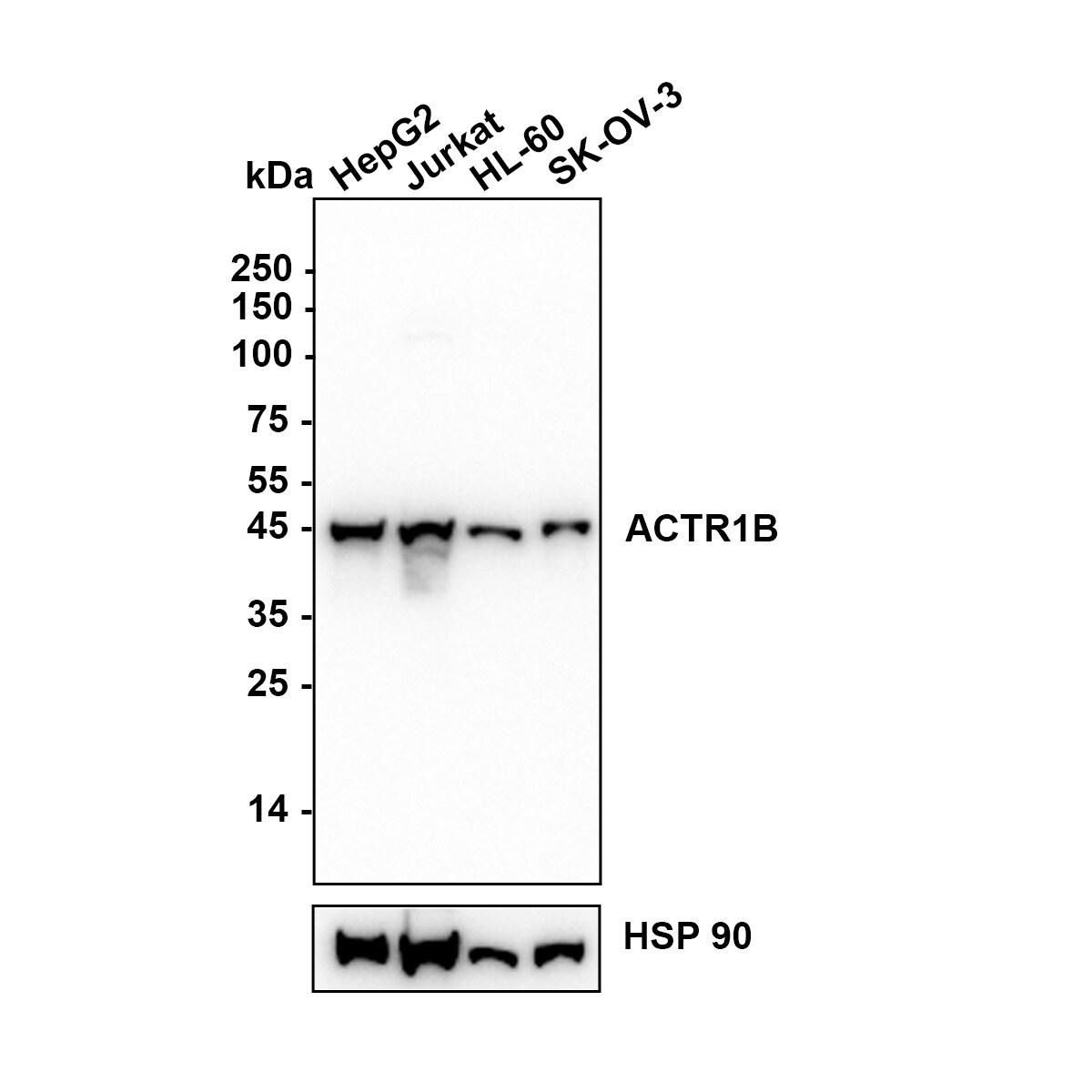 ACTR1B Antibody (JE65-44) Western Blot: ACTR1B Antibody (JE65-44) [NBP3-31999]