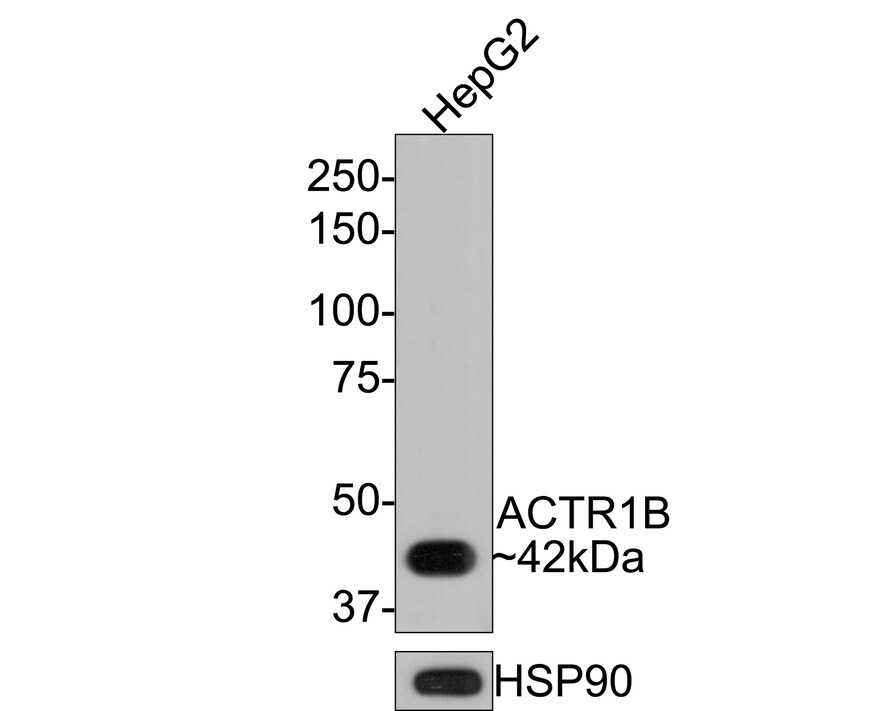 ACTR1B Antibody (JE65-44)