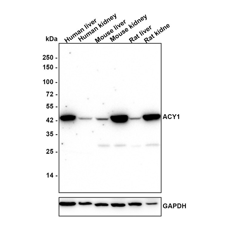 Aminoacylase/ACY1 Antibody (15G2-R) Western Blot: Aminoacylase/ACY1 Antibody (15G2-R) [NBP3-32000]