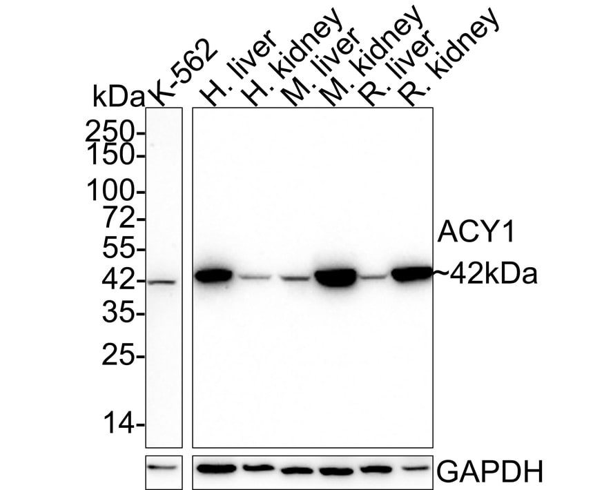 Aminoacylase/ACY1 Antibody (15G2-R)
