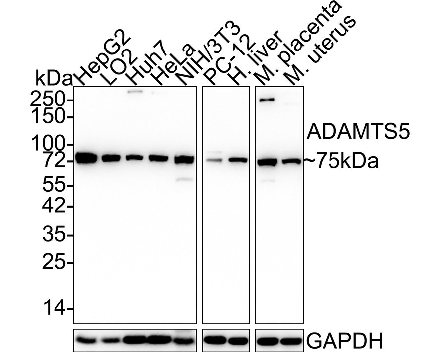 ADAMTS5 Antibody (PSH03-52) Western Blot: ADAMTS5 Antibody (PSH03-52) [NBP3-32001]
