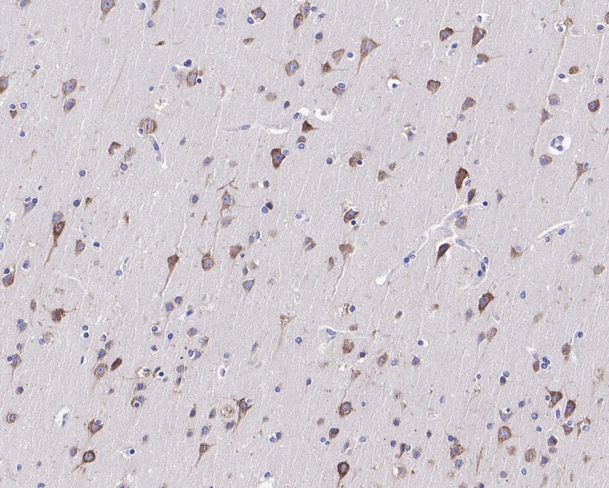 Adenosine A1R Antibody (JE31-35)