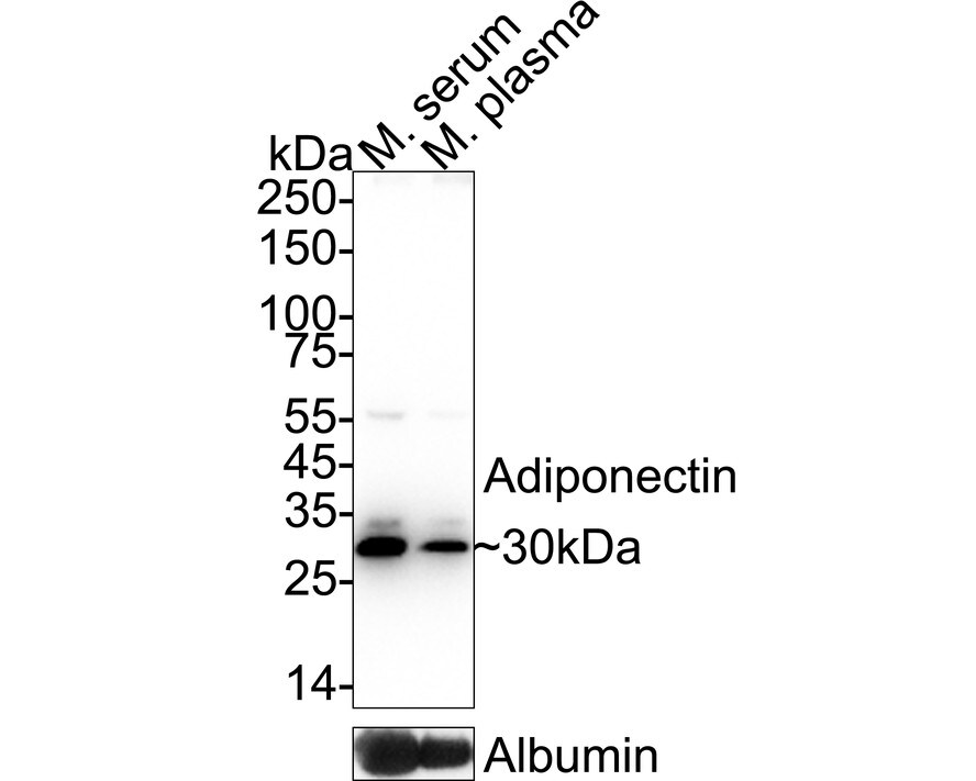 Adiponectin/Acrp30 Antibody (JE65-49) Western Blot: Adiponectin/Acrp30 Antibody (JE65-49) [NBP3-32003]