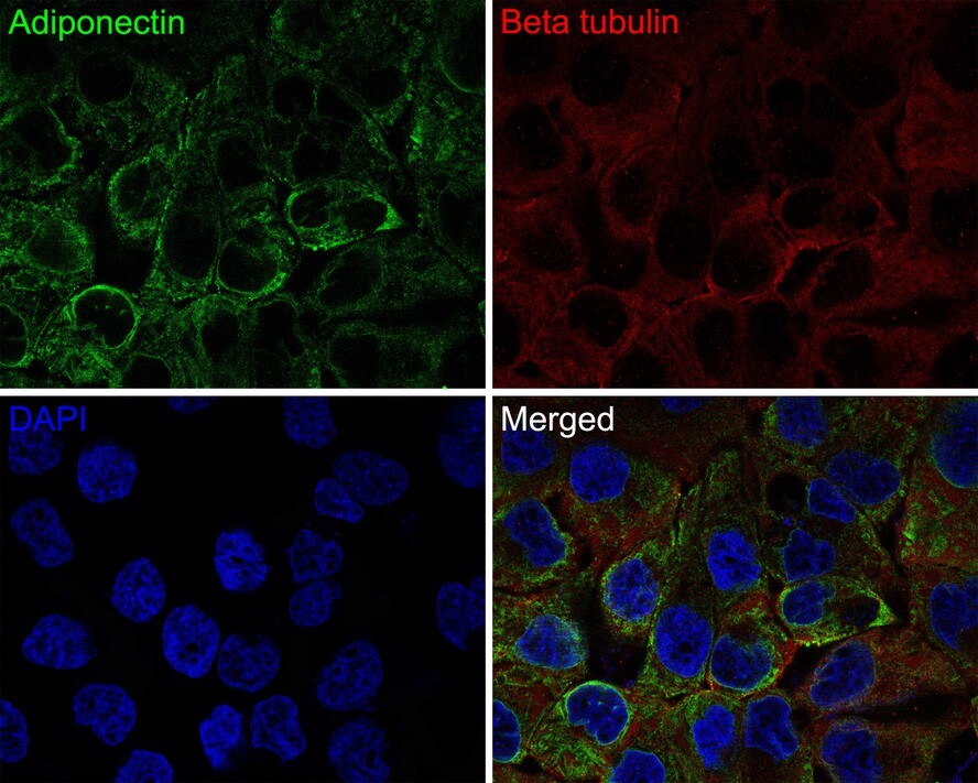 Adiponectin/Acrp30 Antibody (JE65-49)