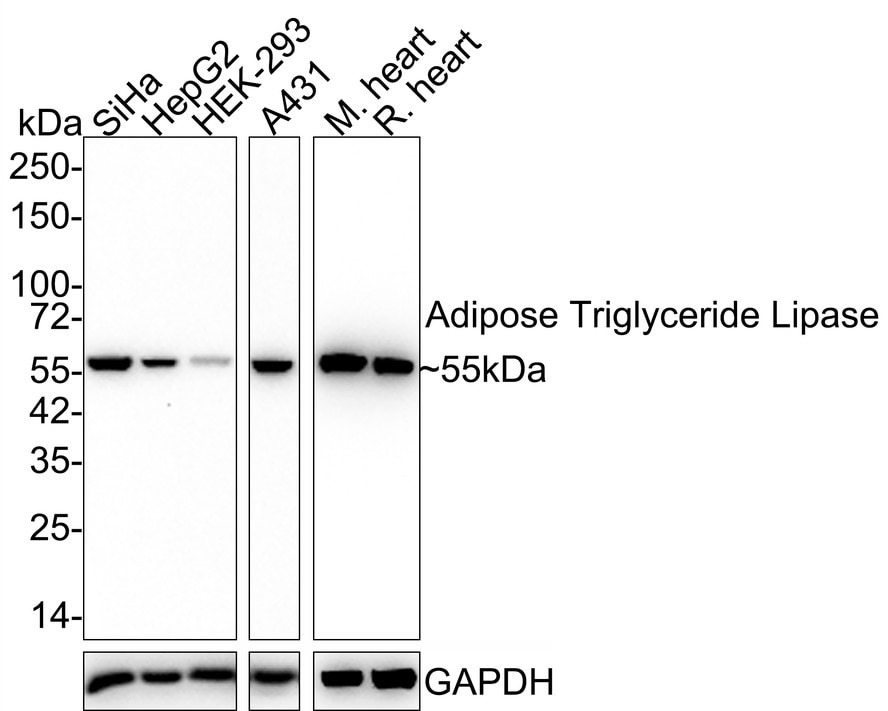 PEDFR/PNPLA2/ATGL Antibody (JE37-49) Western Blot: PEDFR/PNPLA2/ATGL Antibody (JE37-49) [NBP3-32004]