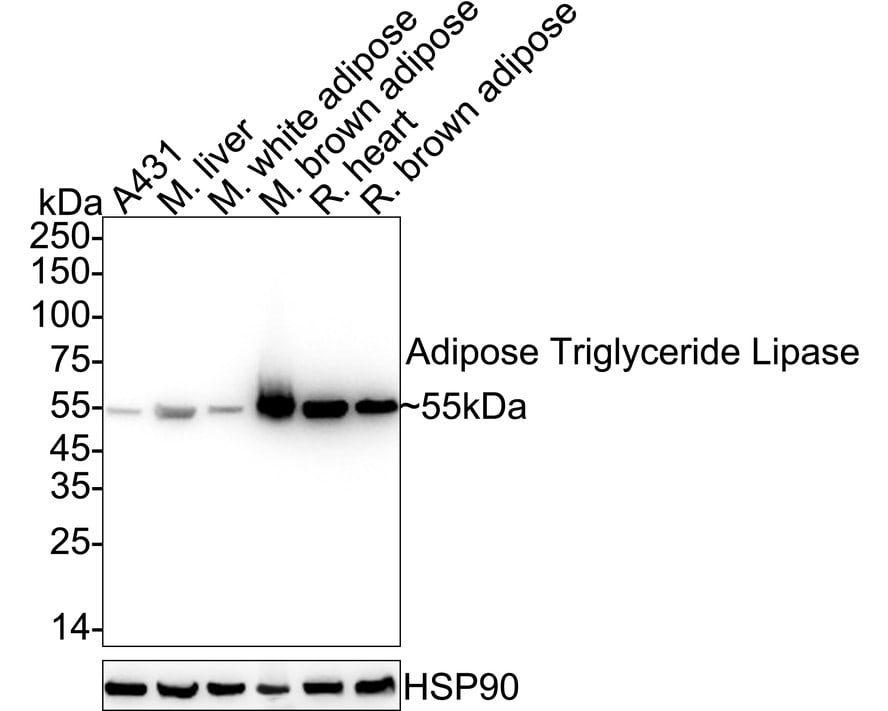 PEDFR/PNPLA2/ATGL Antibody (JE37-49) Western Blot: PEDFR/PNPLA2/ATGL Antibody (JE37-49) [NBP3-32004]