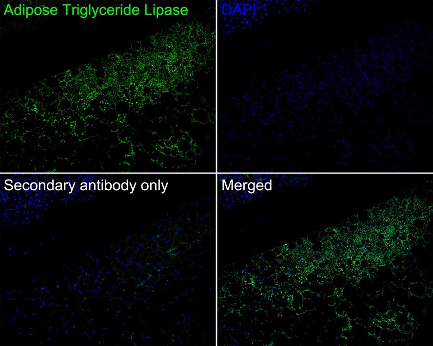 PEDFR/PNPLA2/ATGL Antibody (JE37-49)