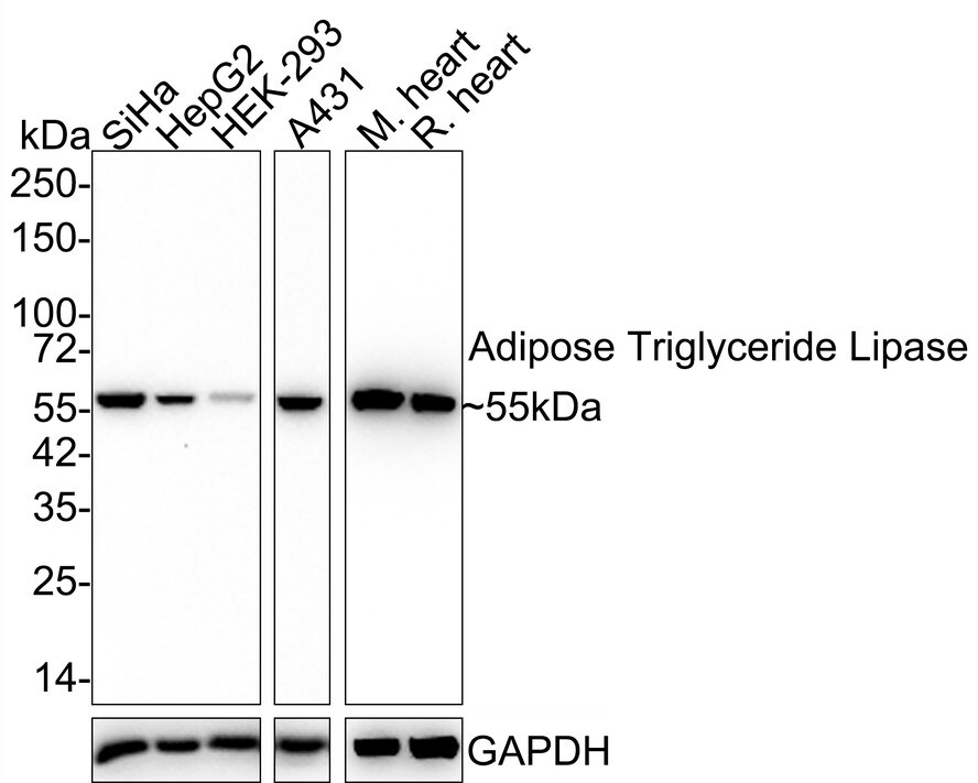 PEDFR/PNPLA2/ATGL Antibody (JE37-49)