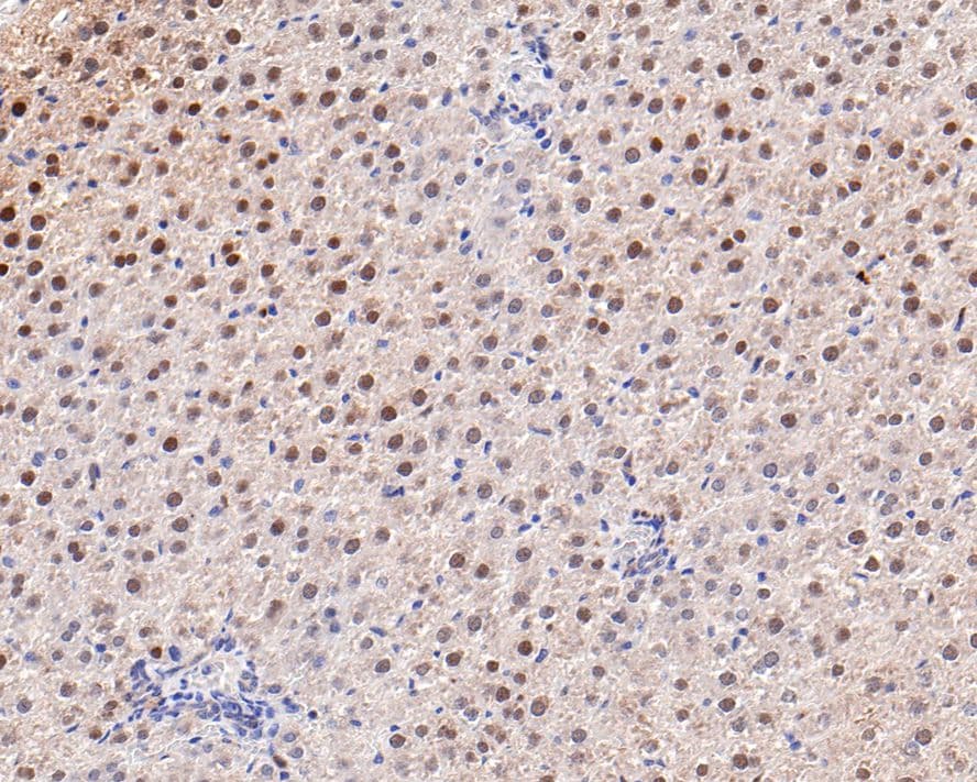 Adenylosuccinate Synthase Antibody (JE64-42)