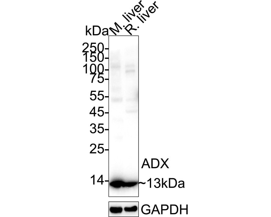 FDX1 Antibody (JE63-56) Western Blot: FDX1 Antibody (JE63-56) [NBP3-32006]