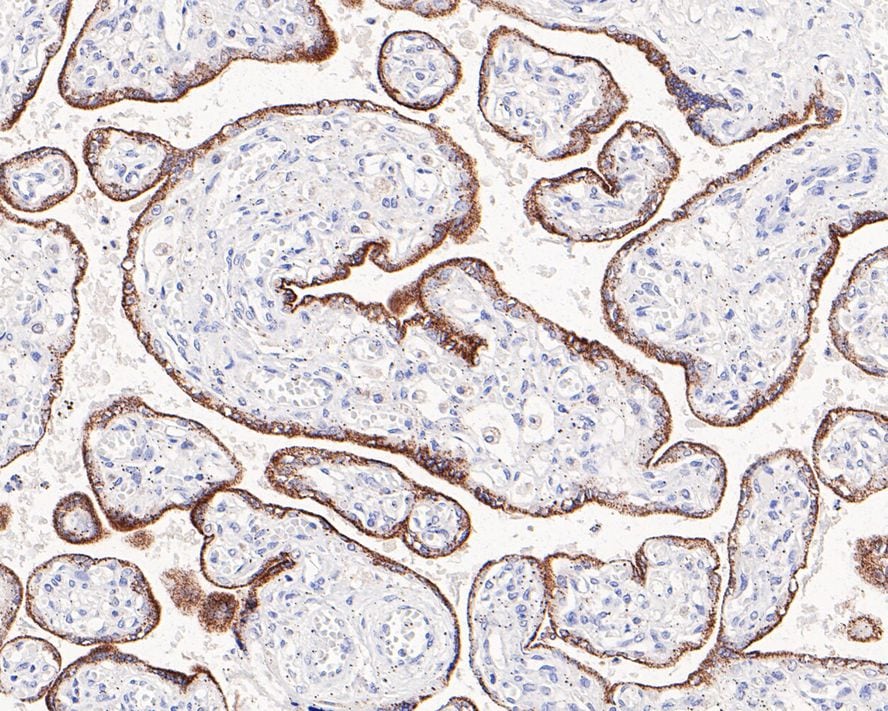 FDX1 Antibody (JE63-56)