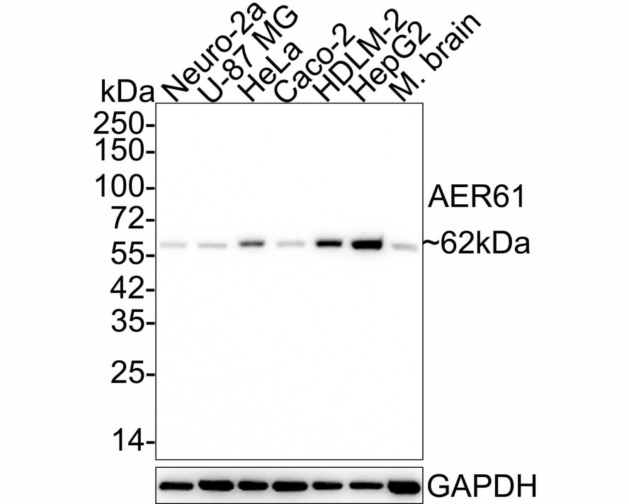 EOGT/AER61 Antibody (JE64-87)