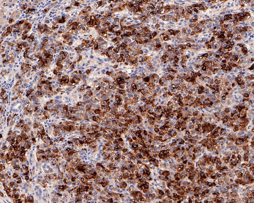 alpha-Fetoprotein/AFP Antibody (PD00-71)