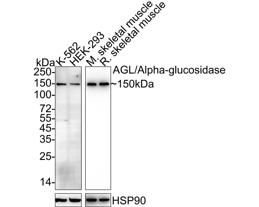 AGL Antibody (PSH04-56) Western Blot: AGL Antibody (PSH04-56) [NBP3-32009]
