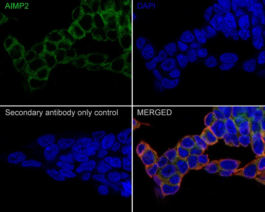 AIMP2 Antibody (PSH0-75)