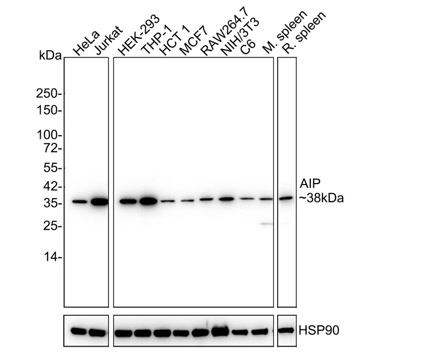 AIP/ARA9 Antibody (PSH03-17) Western Blot: AIP/ARA9 Antibody (PSH03-17) [NBP3-32012]