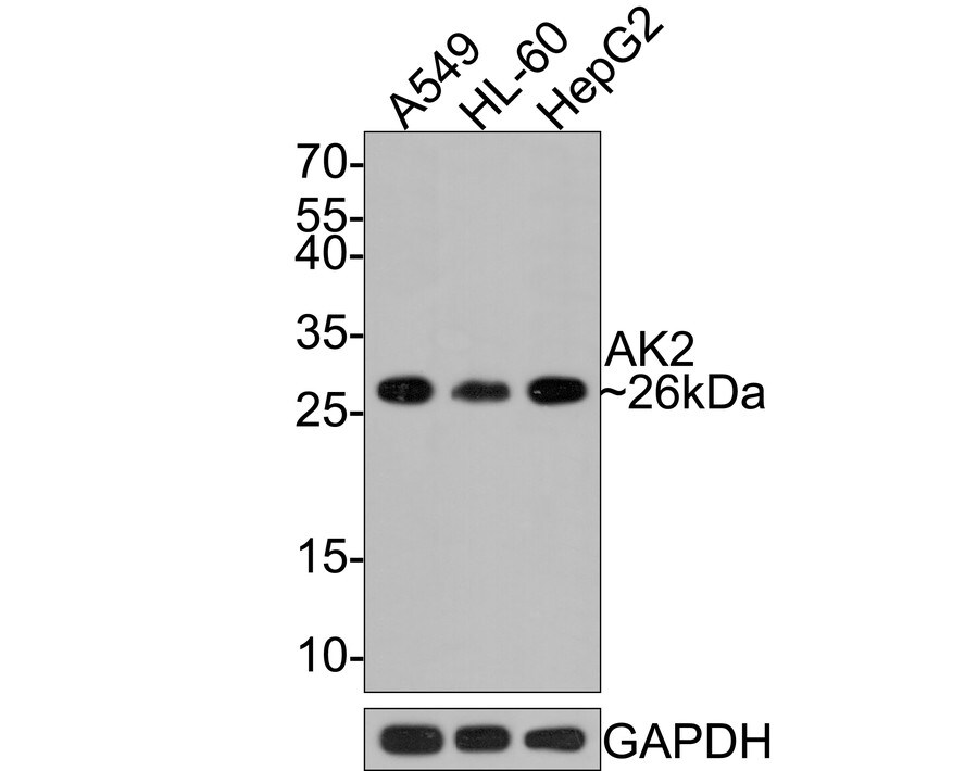 AK2 Antibody (JE64-27) Western Blot: AK2 Antibody (JE64-27) [NBP3-32013]