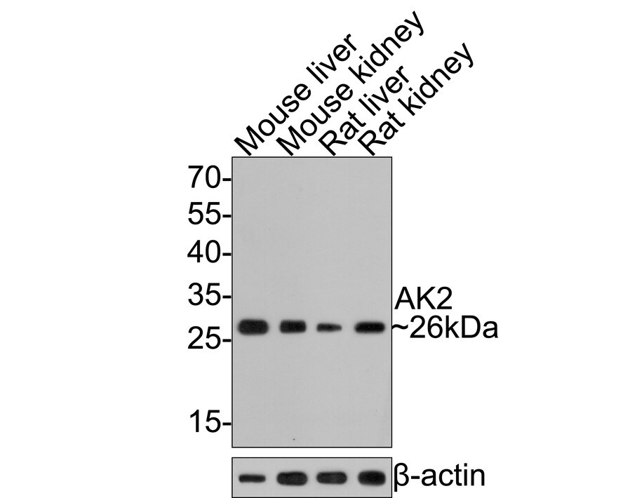 AK2 Antibody (JE64-27) Western Blot: AK2 Antibody (JE64-27) [NBP3-32013]
