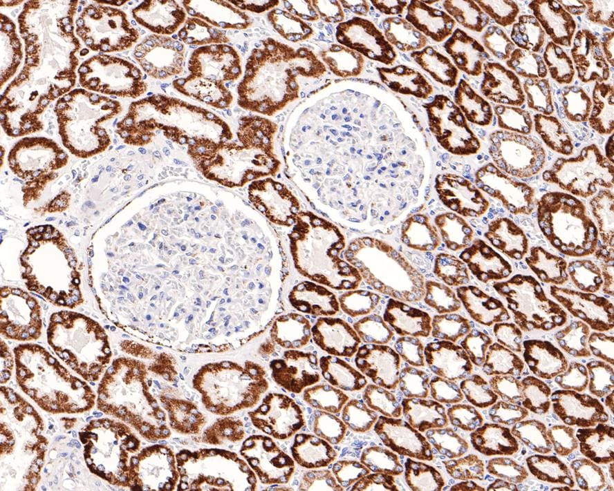 AK2 Antibody (JE64-27)
