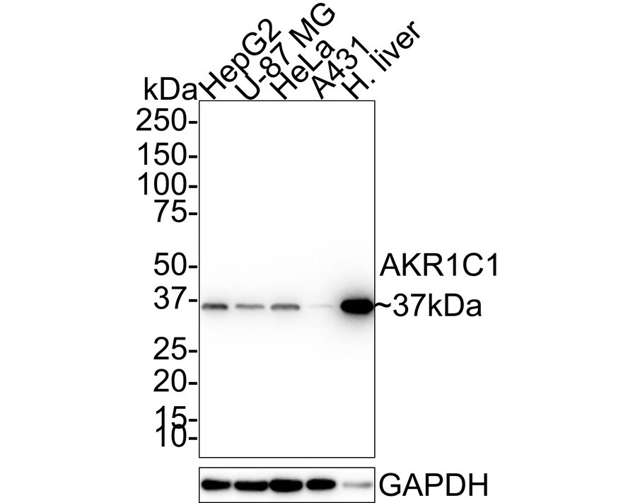 Aldo-keto Reductase 1C1/AKR1C1 Antibody (5-F10-R) Western Blot: Aldo-keto Reductase 1C1/AKR1C1 Antibody (5-F10-R) [NBP3-32014]