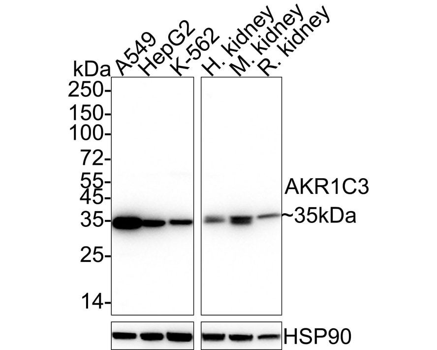Aldo-keto Reductase 1C3/AKR1C3 Antibody (JE36-28) Western Blot: Aldo-keto Reductase 1C3/AKR1C3 Antibody (JE36-28) [NBP3-32015]