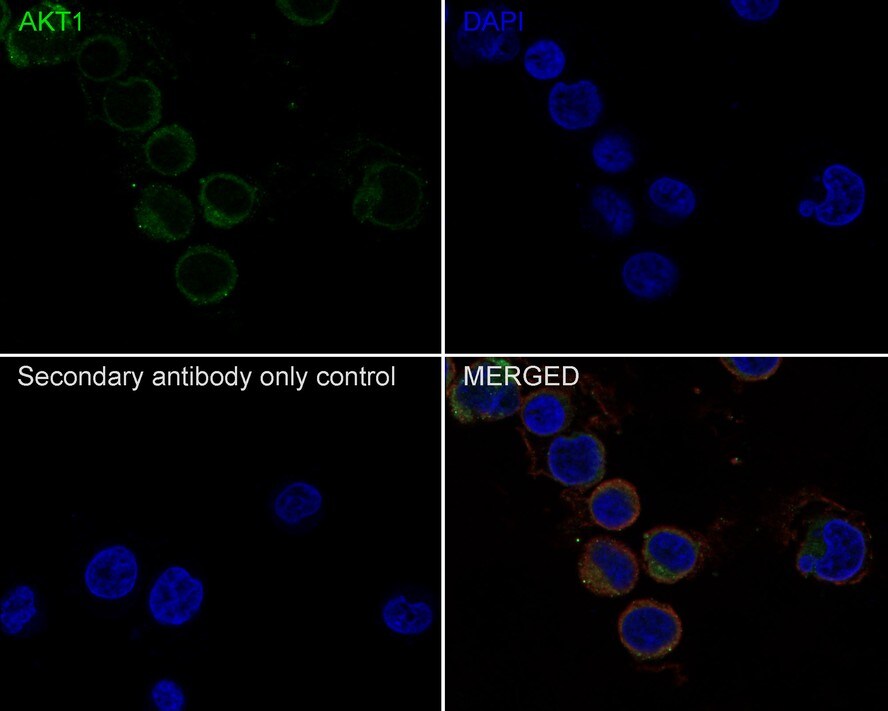 AKT1 Antibody (PSH0-50)
