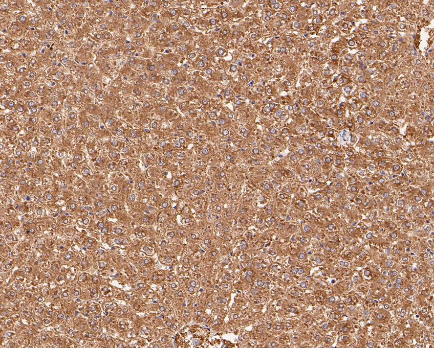 Aldehyde Oxidase 1/AOX1 Antibody (PSH0-17)