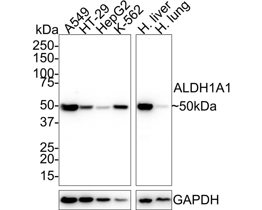 Aldehyde Dehydrogenase 1-A1/ALDH1A1 Antibody (8F1-R) Western Blot: Aldehyde Dehydrogenase 1-A1/ALDH1A1 Antibody (8F1-R) [NBP3-32019]
