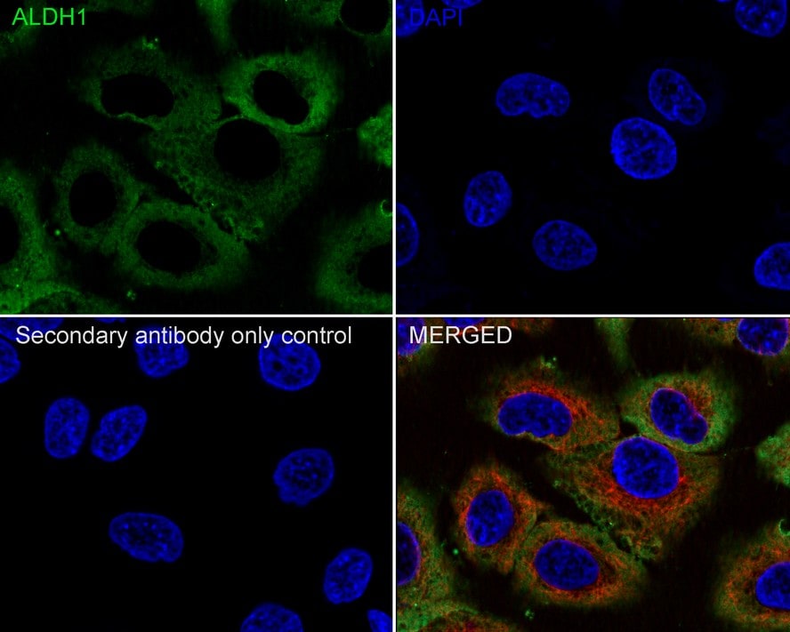 Aldehyde Dehydrogenase 1-A1/ALDH1A1 Antibody (8F1-R)