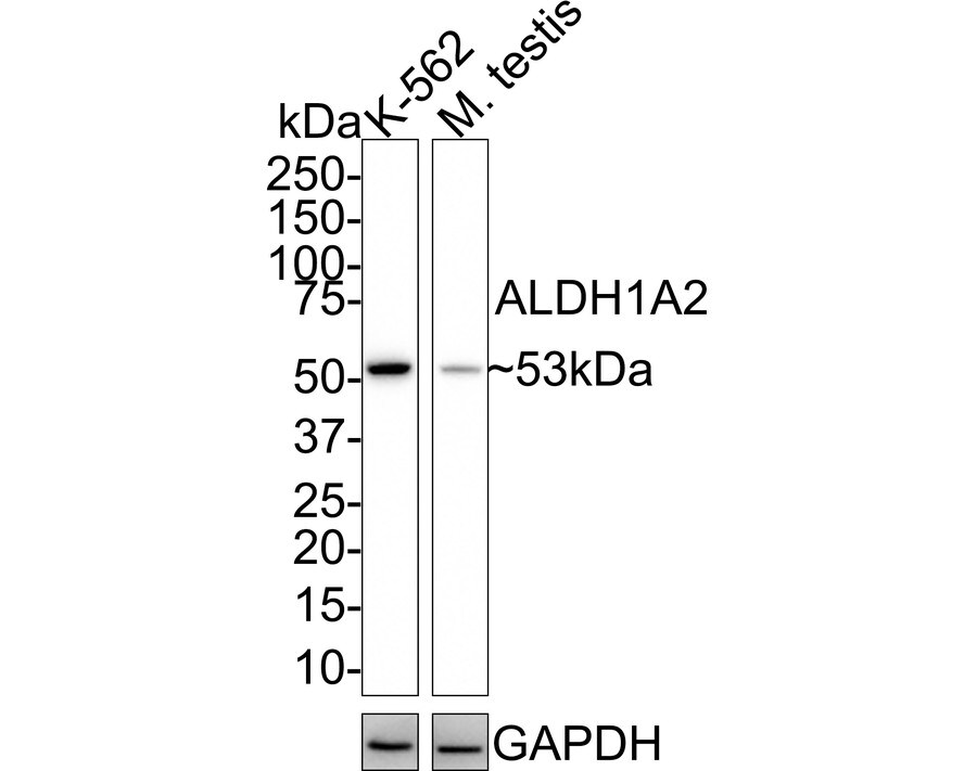 ALDH1A2 Antibody (JE41-38) Western Blot: ALDH1A2 Antibody (JE41-38) [NBP3-32020]