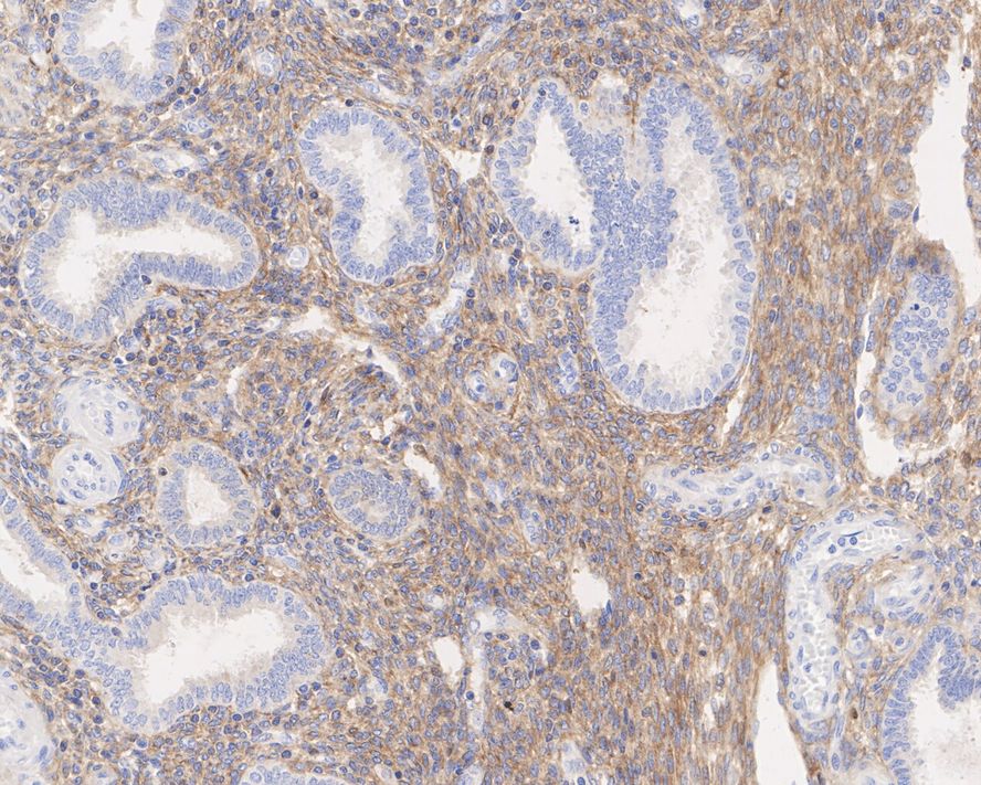 ALDH1A2 Antibody (JE41-38)