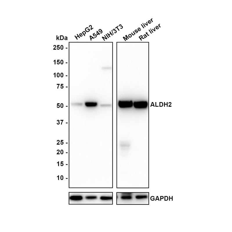 ALDH2 Antibody (E4-D10-R) Western Blot: ALDH2 Antibody (E4-D10-R) [NBP3-32021]