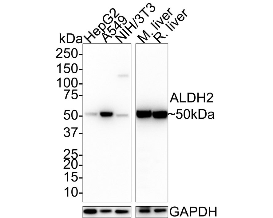 ALDH2 Antibody (E4-D10-R)
