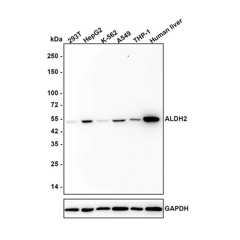 ALDH2 Antibody (7-D8-R) Western Blot: ALDH2 Antibody (7-D8-R) [NBP3-32022]