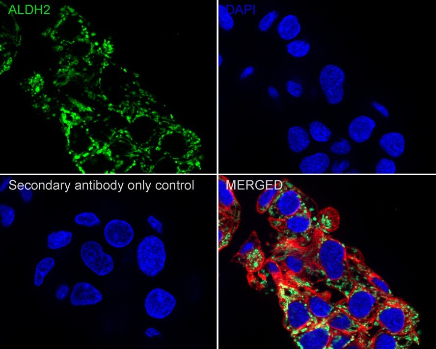 ALDH2 Antibody (7-D8-R)