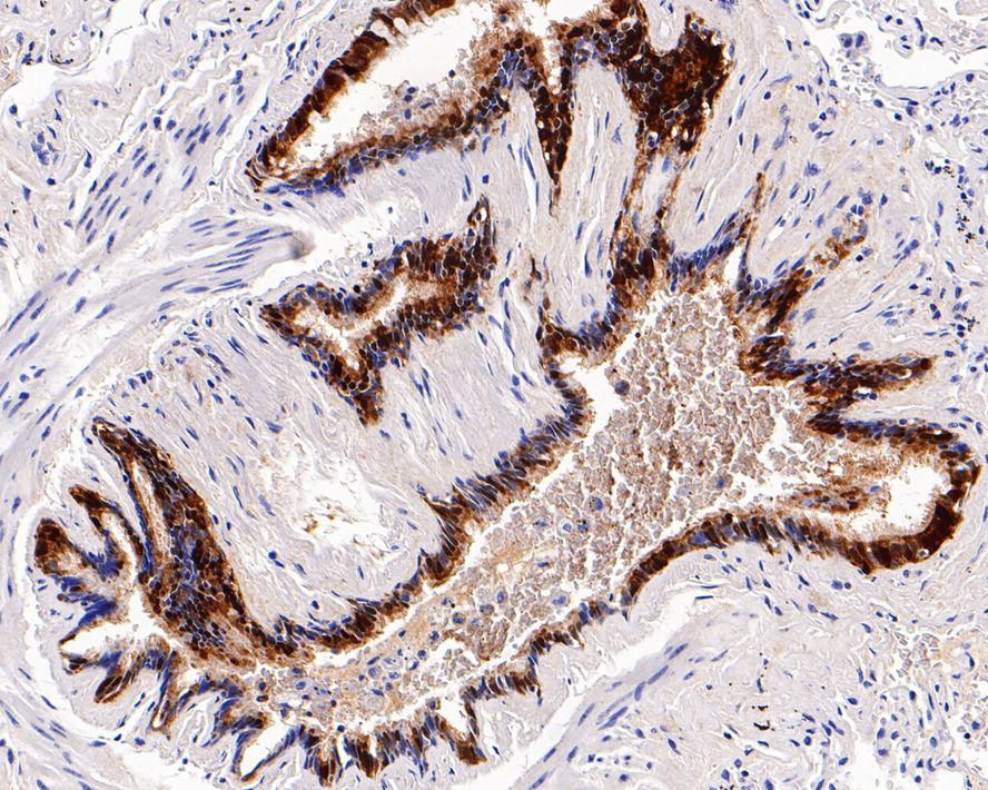Aldehyde Dehydrogenase 3-A1/ALDH3A1 Antibody (PD00-73)