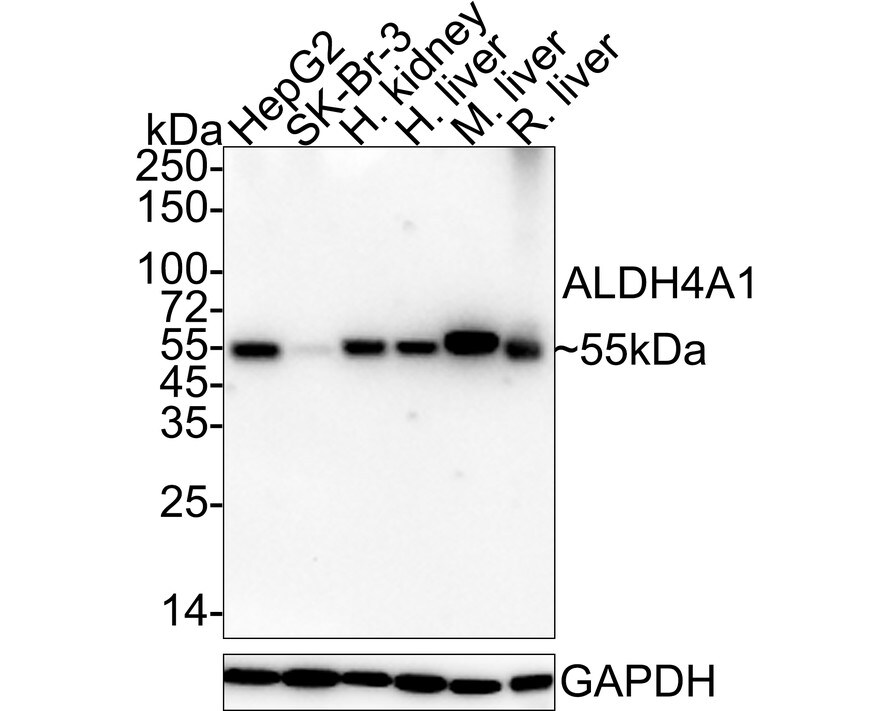 ALDH4A1 Antibody (7E2-R)