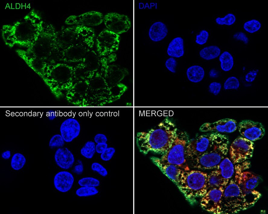 ALDH4A1 Antibody (7E2-R)