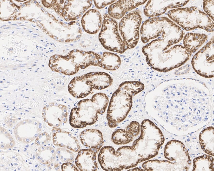 ALDH4A1 Antibody (7E2-R)