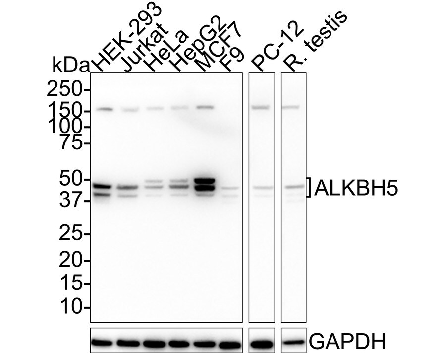 ALKBH5 Antibody (PSH01-16) Western Blot: ALKBH5 Antibody (PSH01-16) [NBP3-32027]
