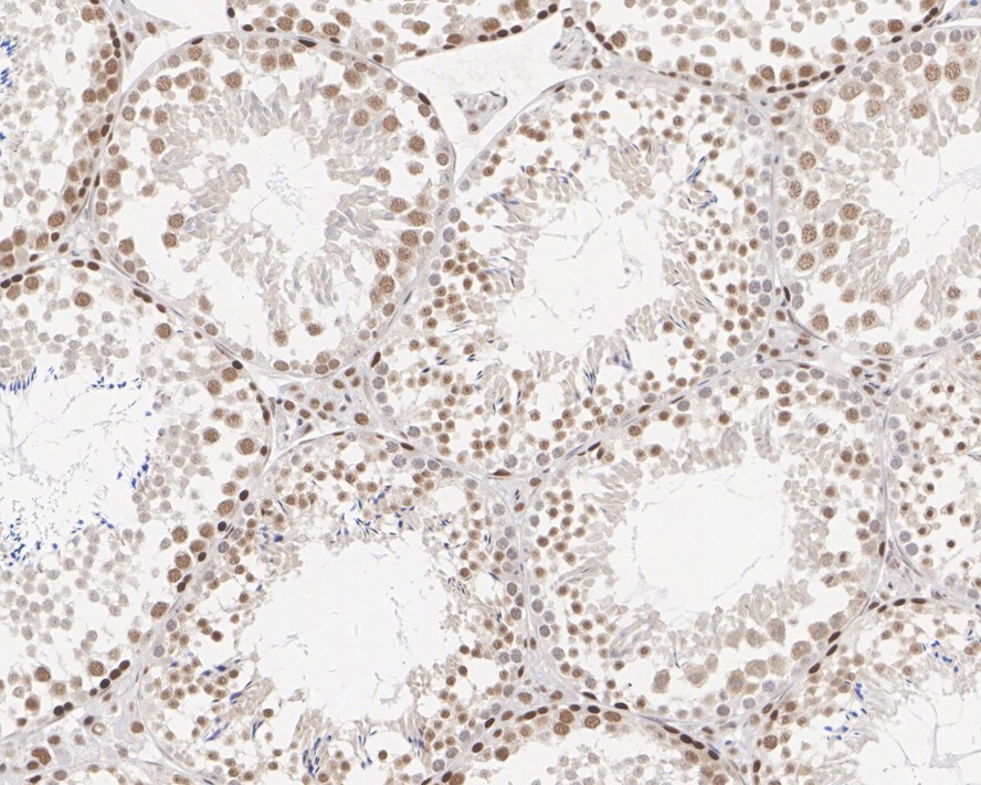 ALKBH5 Antibody (PSH01-16)