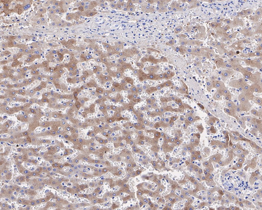 alpha 1-Acid Glycoprotein Antibody (JE31-16)