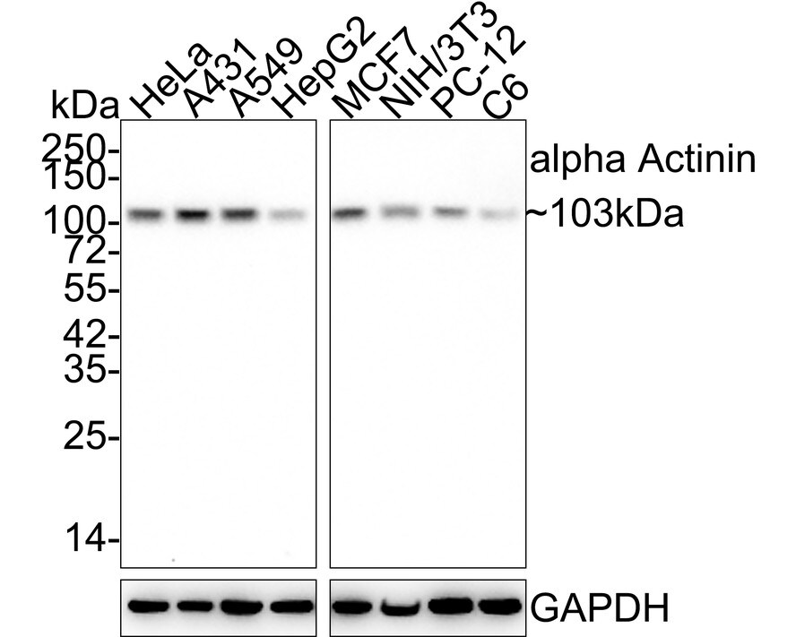 alpha-Actinin 1 Antibody (A1G2-R) Western Blot: alpha-Actinin 1 Antibody (A1G2-R) [NBP3-32030]