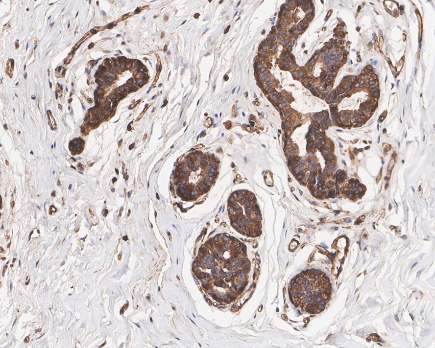 alpha-Actinin 1 Antibody (A1G2-R)